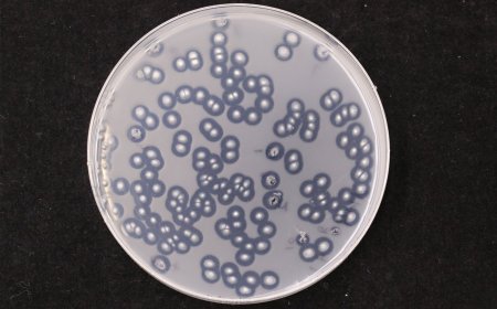 Plastic-eating fungi thriving in man-made 'plastisphere' may help tackle global waste